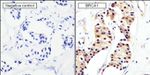 BRCA1 Antibody in Immunohistochemistry (Paraffin) (IHC (P))