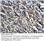 BTK Antibody in Immunohistochemistry (IHC)