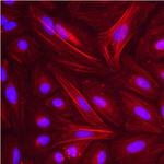 beta Actin Antibody in Immunocytochemistry (ICC/IF)