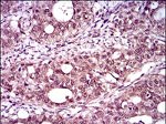 Brachyury Antibody in Immunohistochemistry (Paraffin) (IHC (P))