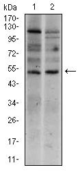 Brachyury Antibody in Western Blot (WB)