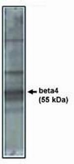 Calcium Channel beta-4 Antibody in Western Blot (WB)