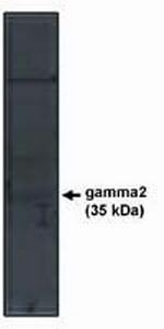 CACNB2 Antibody in Western Blot (WB)