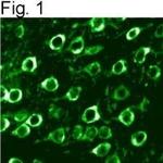 Calreticulin Antibody in Immunohistochemistry (IHC)