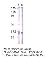 CaMKII gamma Antibody in Western Blot (WB)