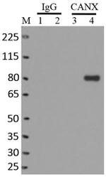 Calnexin Antibody in Immunoprecipitation (IP)