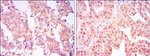 PRMT4 Antibody in Immunohistochemistry (Paraffin) (IHC (P))