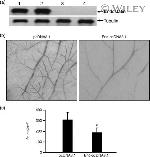 Endostatin Antibody in Western Blot (WB)