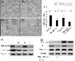 Endostatin Antibody in Western Blot (WB)