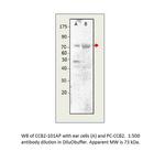 CACNB2 Antibody in Western Blot (WB)