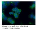 CCK4 Antibody in Immunohistochemistry (IHC)