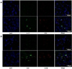 IL-17A Antibody in Immunocytochemistry (ICC/IF)