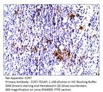 CCR7 Antibody in Immunohistochemistry (IHC)