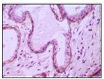 CD10 Antibody in Immunohistochemistry (Paraffin) (IHC (P))