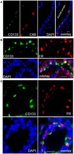 CD133 (Prominin-1) Antibody in Immunohistochemistry (IHC)