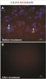 CD133 (Prominin-1) Antibody in Immunocytochemistry (ICC/IF)