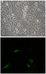 CD133 (Prominin-1) Antibody in Immunohistochemistry (IHC)