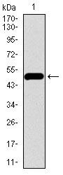 VE-cadherin Antibody in Western Blot (WB)