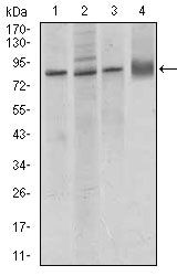 VE-cadherin Antibody in Western Blot (WB)