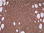 CD20 Antibody in Immunohistochemistry (Paraffin) (IHC (P))