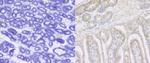 ITGB1 Antibody in Immunohistochemistry (Paraffin) (IHC (P))