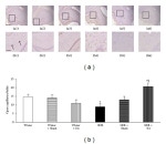 CD31 Antibody in Immunohistochemistry (IHC)