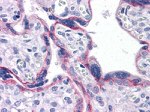 N-cadherin Antibody in Immunohistochemistry (Paraffin) (IHC (P))