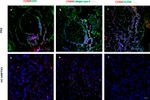 CD45 Antibody in Immunohistochemistry (IHC)