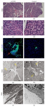 CD45 Antibody in Immunohistochemistry (IHC)