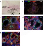 CD49f (Integrin alpha 6) Antibody in Immunohistochemistry (IHC)