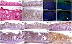 CD4 Antibody in Immunohistochemistry (IHC)