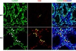 PTBP1 Antibody in Immunocytochemistry (ICC/IF)