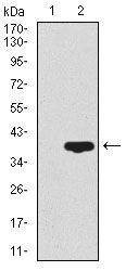 CD59 Antibody in Western Blot (WB)