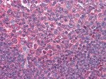 CD80 Antibody in Immunohistochemistry (Paraffin) (IHC (P))