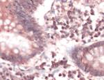 FAS Antibody in Immunohistochemistry (Paraffin) (IHC (P))