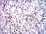 CDK2 Antibody in Immunohistochemistry (Paraffin) (IHC (P))