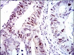 CDK2 Antibody in Immunohistochemistry (Paraffin) (IHC (P))