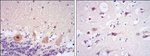 CDK5 Antibody in Immunohistochemistry (Paraffin) (IHC (P))