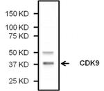 CDK9 Antibody in Western Blot (WB)