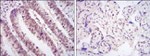 CDK9 Antibody in Immunohistochemistry (Paraffin) (IHC (P))