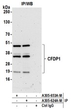 CFDP1 Antibody in Western Blot (WB)