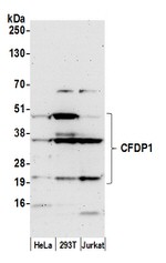 CFDP1 Antibody in Western Blot (WB)