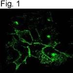 CFTR Antibody in Immunocytochemistry (ICC/IF)