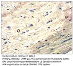 Chimaerin beta 2 Antibody in Immunohistochemistry (IHC)