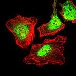 Cytokeratin 5 Antibody in Immunocytochemistry (ICC/IF)