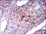 Cytokeratin 5 Antibody in Immunohistochemistry (Paraffin) (IHC (P))