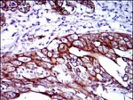 Cytokeratin 5 Antibody in Immunohistochemistry (Paraffin) (IHC (P))