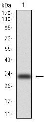 Cytokeratin 5 Antibody in Western Blot (WB)