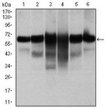 Cytokeratin 5 Antibody in Western Blot (WB)