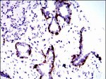 Cytokeratin 5 Antibody in Immunohistochemistry (Paraffin) (IHC (P))